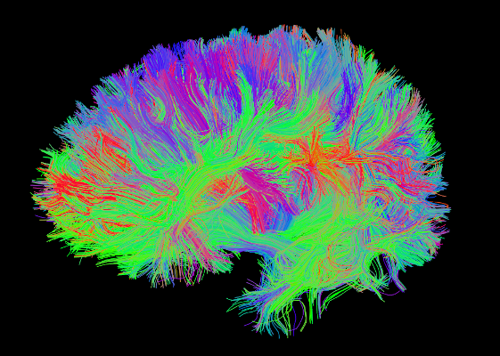 _images/ex_tractography1.png